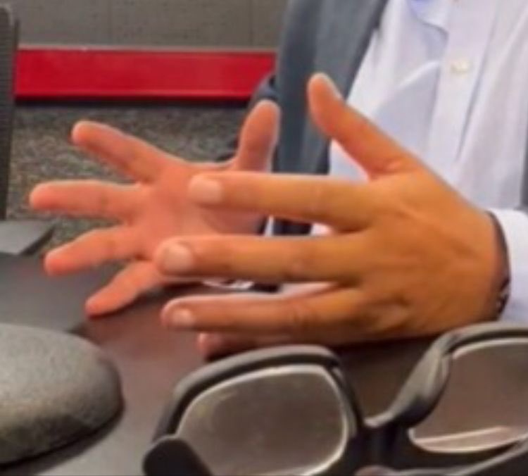 TRIVIA

Estas manitas son de:

🔁Citadino
💟Paisano