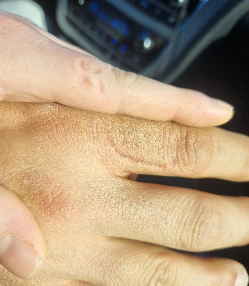 서로 사이좋게 이빨 자국 ,, 🤭
손만 봐도 멋있는 내 주인님 😆😆