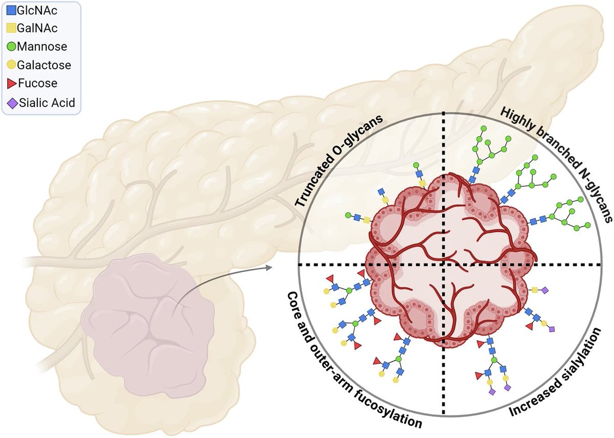 An #OpenAccess review on glycosylation in #PancreaticCancer 

Leveraging glycosylation for early detection and therapeutic target discovery in pancreatic cancer
nature.com/articles/s4141…