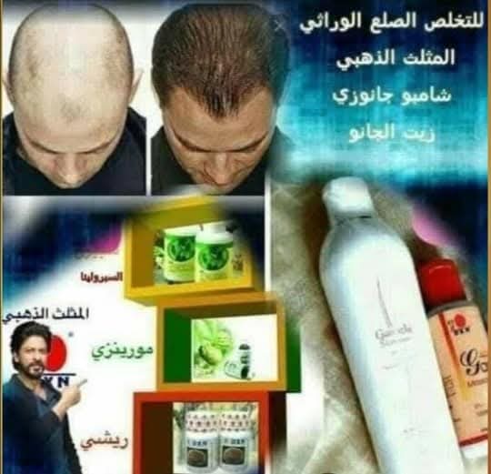 #علاج_الصلع وتساقط الشعر 
منتجات جديدة  ومذهلة لـــ  ​نمو شعر جديد​
#وداعا_لجلسات_الزرع
#وداعا_لتساقط_الشعر 
لمن يعاني من تساقط الشعر،
او لديه صلع،او يعاني من القشرة
منتجات دكسن هوة الحل باذن الله 
١.شامبو جانوزي
٢.زيت جانو للتدليك
٣.سبيرولينا 
لأستفسارتكم
wa.me/33758863684