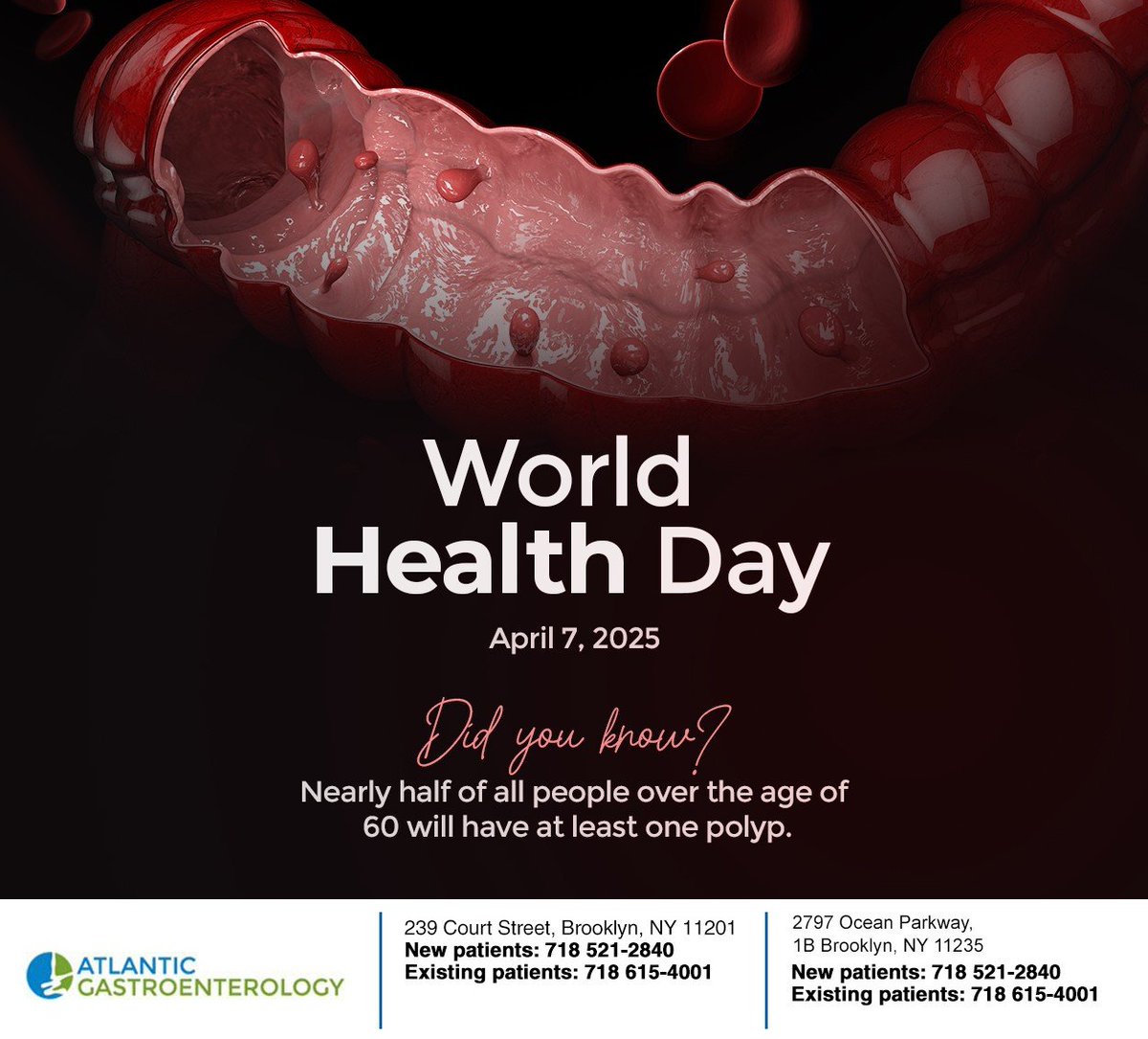 AtGastro_NYC's tweet image. Colon polyps are more likely to develop in older people and are usually harmless. Screening is necessary to determine if polyps are cancerous. Learn more at atgastro.com #colonpolyps #brooklyn #atlanticgastroenterology #NY