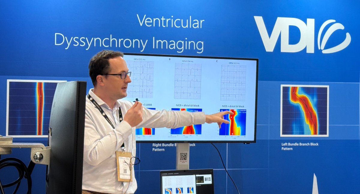 Mirek Navratil (@mireknavratil1) on Twitter photo Today at 9:45 at
#EHRA2025 we have two esteemed <a href="/OCanoPerez/">Óscar Cano</a> and <a href="/curilakarol/">curilakarol</a> share practical experiences with UHF-ECG at booth B120 Today at 9:45 at
#EHRA2025 we have two esteemed <a href="/OCanoPerez/">Óscar Cano</a> and <a href="/curilakarol/">curilakarol</a> share practical experiences with UHF-ECG at booth B120