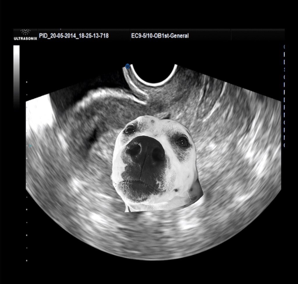 Tyler’s the father