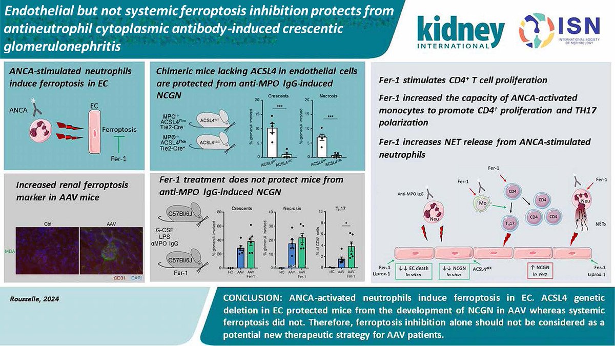 Maine-Anjou AAV-GN Research Group (@maineanjoureg) on Twitter photo Targeting endothelial ferroptosis protects kidneys in #ANCA -associated #vasculitis, while systemic inhibition increases inflammation). This is why cell-specific therapies should be prioritised over blanket treatments! <a href="/Kidney_Int/">Kidney International</a> <a href="/AdrianSchreibe8/">Adrian Schreiber</a> doi.org/10.1016/j.kint… Targeting endothelial ferroptosis protects kidneys in #ANCA -associated #vasculitis, while systemic inhibition increases inflammation). This is why cell-specific therapies should be prioritised over blanket treatments! <a href="/Kidney_Int/">Kidney International</a> <a href="/AdrianSchreibe8/">Adrian Schreiber</a> doi.org/10.1016/j.kint…