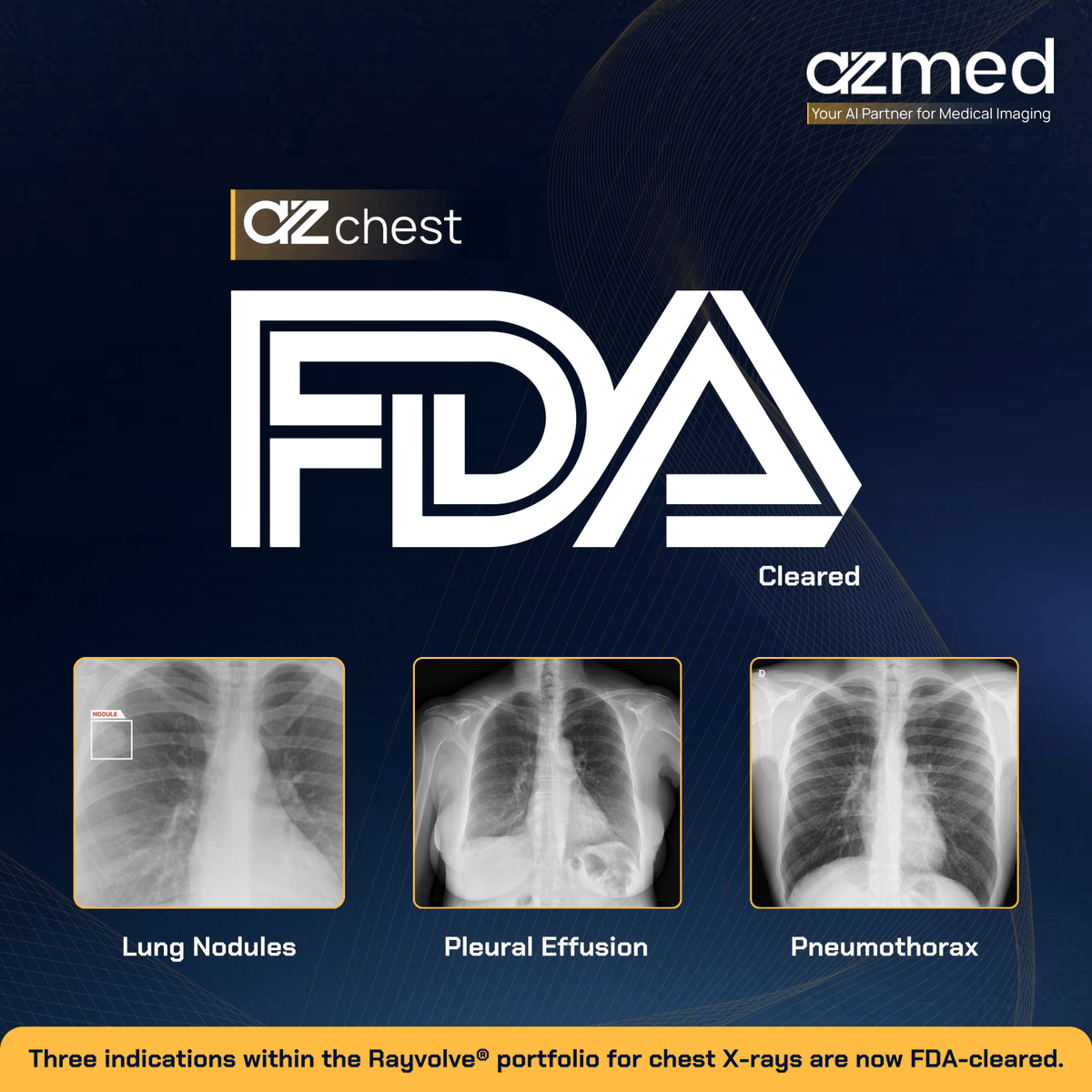 AZmed_AI's tweet image. 🎉 AZmed has received not one, but two new FDA clearances!
We are proud to announce that AZmed has received two new FDA clearances for its AI tool AZchest. The clearances include applications intended to assist radiologists in the identification and review of chest X-rays for…