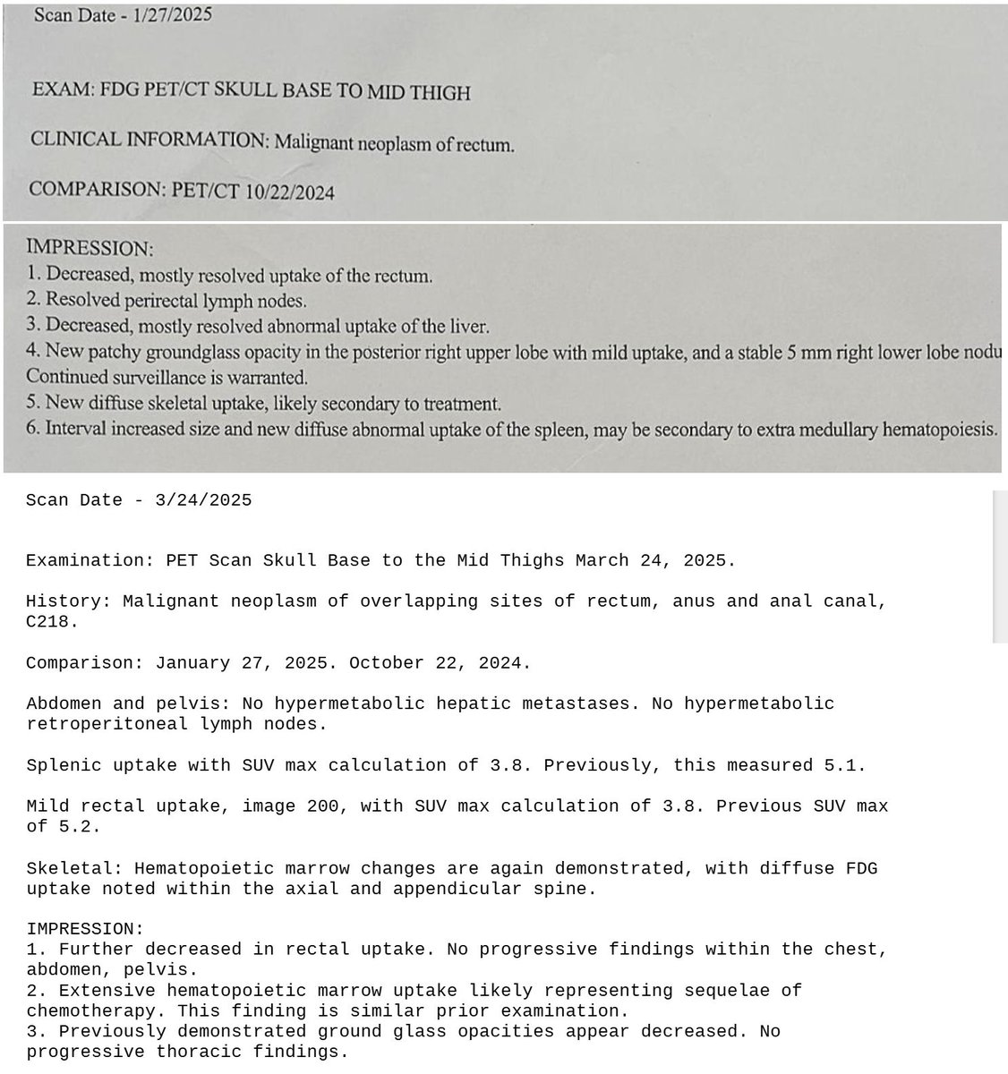 MakisMedicine's tweet image. NEW ARTICLE: IVERMECTIN and FENBENDAZOLE Testimonial - 77 year old woman with Stage 4 Anorectal Neuroendocrine Small Cell Cancer Carcinoma with liver and bone metastases becomes Cancer Free after 5 months!

Another incredible success story! 😃

77 year old woman (USA) was…