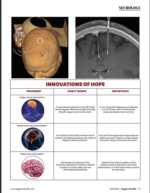 Seizures don’t always play by the rules — but today’s science is learning to keep up.
This article explores how new tech is making epilepsy care smarter, faster, and more human.
For those living with drug-resistant epilepsy, there’s more hope than ever before.