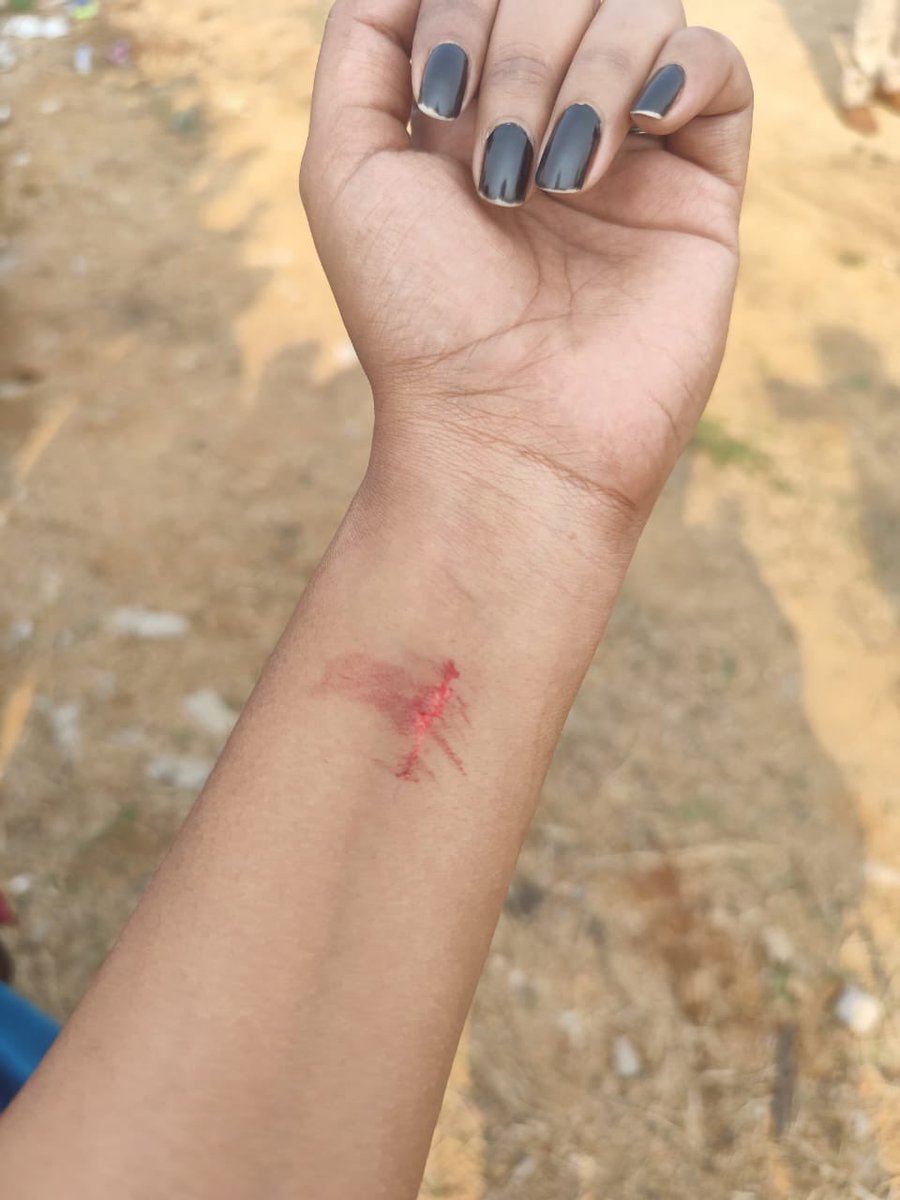 JournoSaumya's tweet photo. हैदराबाद यूनिवर्सिटी से सटी 400 एकड़ जमीन पर तेलंगाना सरकार बुलडोज़र चला रही है। जंगलों को उजाड़ा जा रहा है। इसके खिलाफ़ प्रदर्शन कर रहे छात्रों को हिरासत में लिया जा रहा है, उन्हें घसीटा जा रहा है। तथाकथित विकास के नाम पर पर्यावरण और हजारों वन्यजीवों का दम घोंटा जा रहा है। https://t.co/AzYVD2K5UG