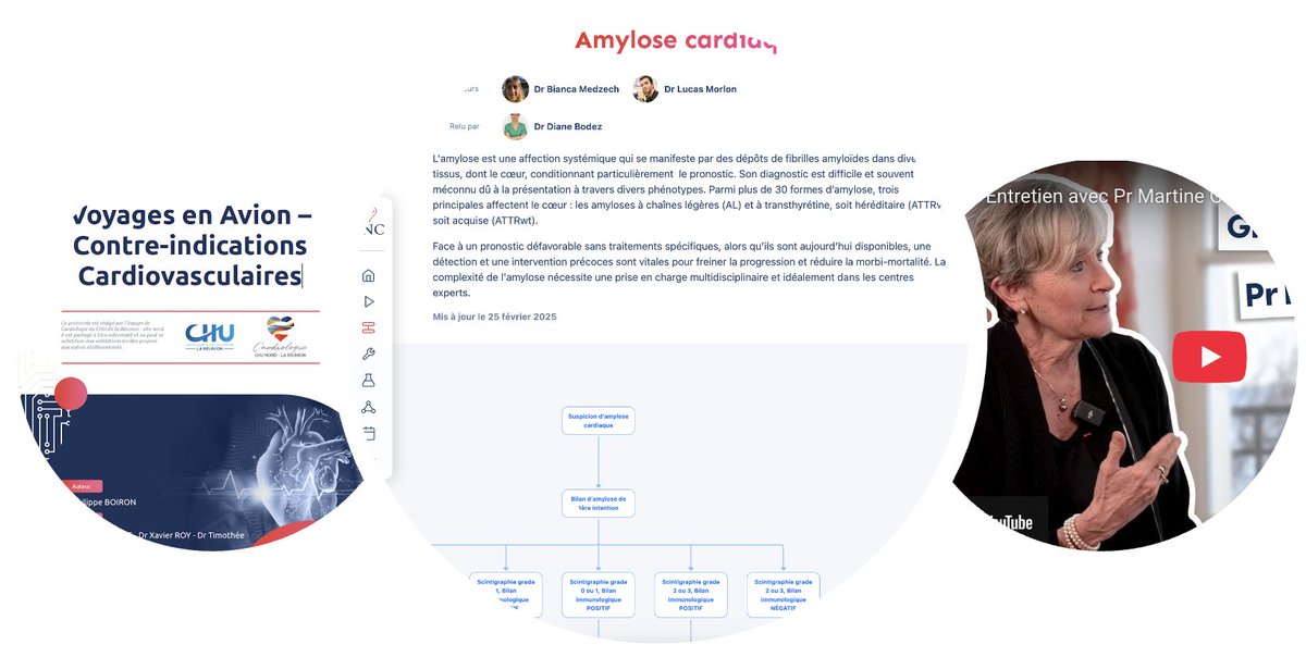 EcoleNumCardio's tweet photo. 📊 Ce que vous avez le + consulté en mars sur l’ENC !
https://t.co/QTJ3v61jMo

🛫 Voyages en avion (outil #1)

🎥 Pr Martine Gilard (vidéo #1)

🧬 Amylose cardiaque (protocole #1)

📚 100 % gratuit, 100 % pratique, 100 % cardio.

#cardiologie #medecine #ENC #sante https://t.co/k0Pu7hKfDn