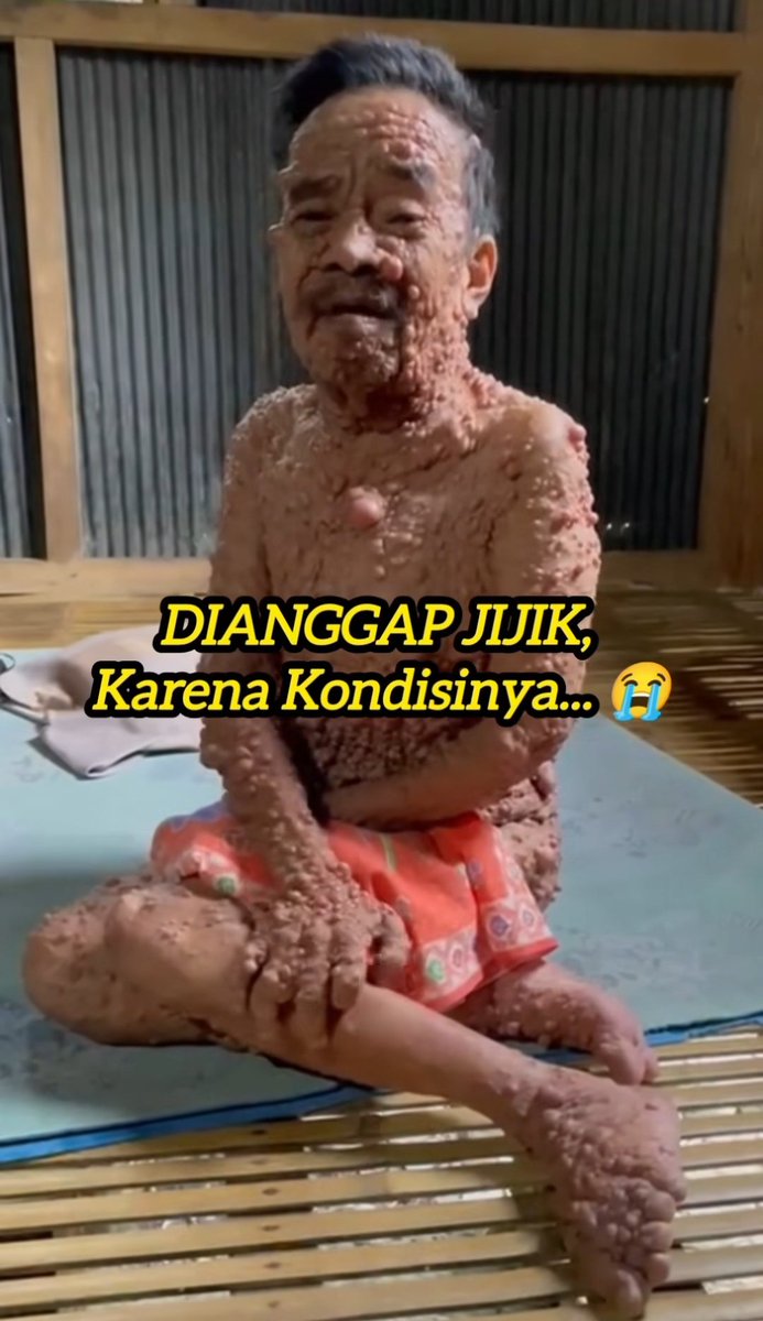 Yang kayak gini bisa kita minta ke dinas sosial aja ga sih supaya mereka dirawat negara??