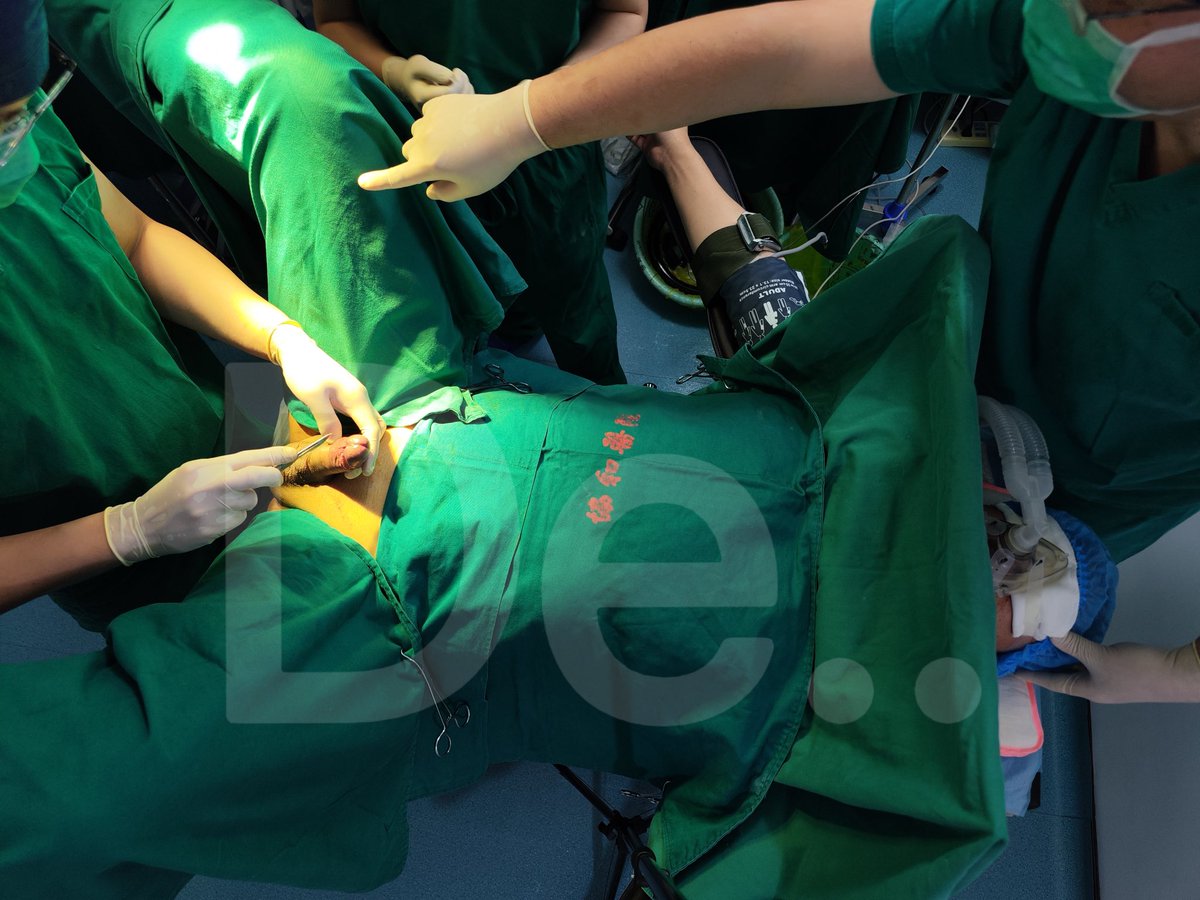 被绑在手术台上，蒙住双眼，面罩里放上兴奋剂，等待着全程清醒的手术治疗。