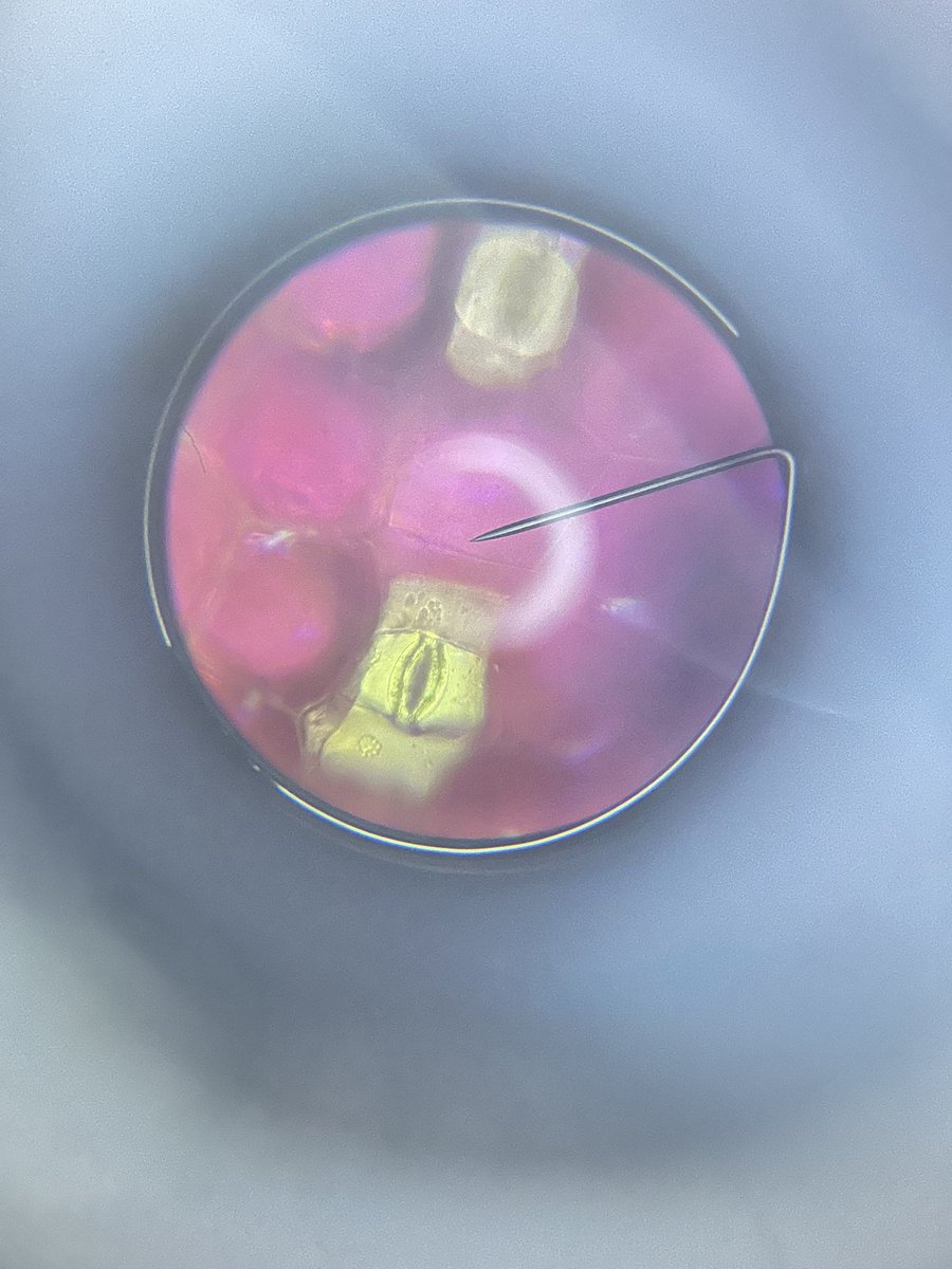 MissGriffithSci's tweet photo. Had a great time in Biology club this afternoon investigating stomata using microscopes! 🔬🌷 https://t.co/vpMJnfF86l