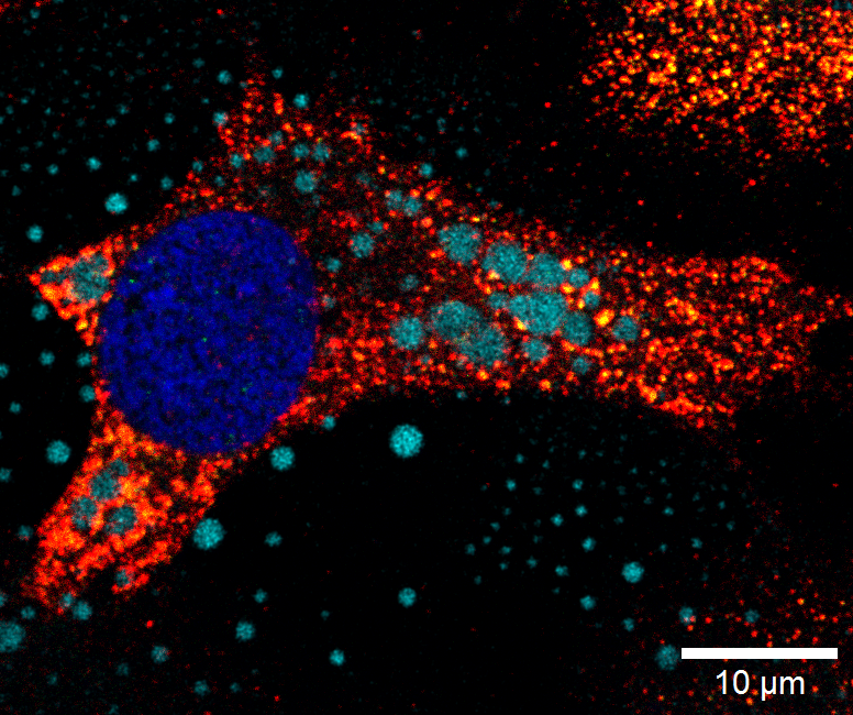 NEX Ciencia y Tecno (@nex_ciencia) on Twitter photo 👩🔬 Investigadoras del <a href="/iquibicen/">IQUIBICEN - CONICET - UBA</a> lograron demostrar la centralidad de las gotas lipídicas en el mecanismo de replicación del virus Junín. El hallazgo abre la puerta a nuevas alternativas terapéuticas contra el Arenavirus causante de la fiebre hemorrágica argentina. 👩🔬 Investigadoras del <a href="/iquibicen/">IQUIBICEN - CONICET - UBA</a> lograron demostrar la centralidad de las gotas lipídicas en el mecanismo de replicación del virus Junín. El hallazgo abre la puerta a nuevas alternativas terapéuticas contra el Arenavirus causante de la fiebre hemorrágica argentina.