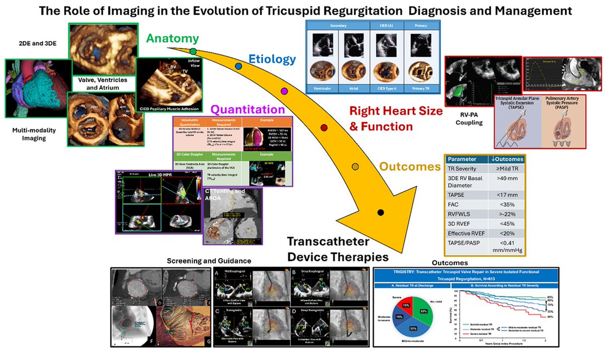 The Heart (@zheart11768530) on Twitter photo 🔴The Last Decade in Tricuspid Regurgitation: How Imaging Shaped a Field⤵️ State-of-the-art #2025Review <a href="/JACCJournals/">JACC Journals</a>
🔹jacc.org/doi/10.1016/j.…
#Cardiology #FOAMed #MedEd #medstudent #paramedic #Cardiology #CardioEd #medtwitter #meded #CardioTwitter #cardiotwiteros #MedX 🔴The Last Decade in Tricuspid Regurgitation: How Imaging Shaped a Field⤵️ State-of-the-art #2025Review <a href="/JACCJournals/">JACC Journals</a>
🔹jacc.org/doi/10.1016/j.…
#Cardiology #FOAMed #MedEd #medstudent #paramedic #Cardiology #CardioEd #medtwitter #meded #CardioTwitter #cardiotwiteros #MedX