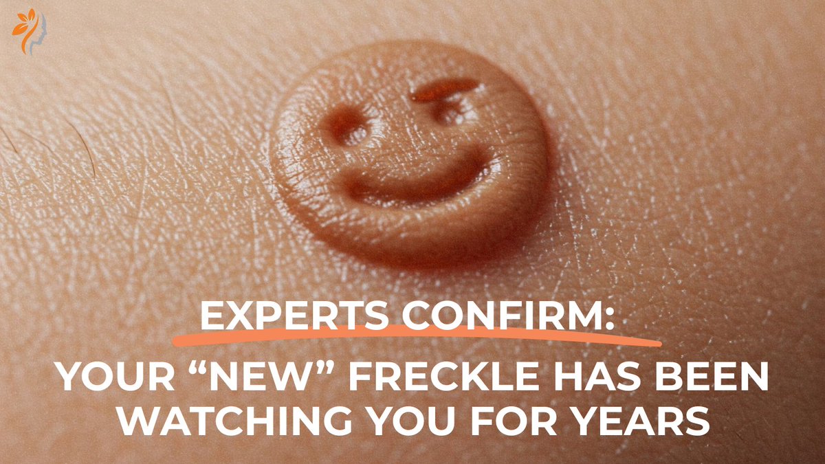 Dermatologists Warn: That one freckle you just noticed has probably been there for 10 years… but why is it staring into your soul? 👀

Experts say freckles are harmless—unless they start whispering secrets about your past. Wear sunscreen. Stay vigilant. #AprilFools