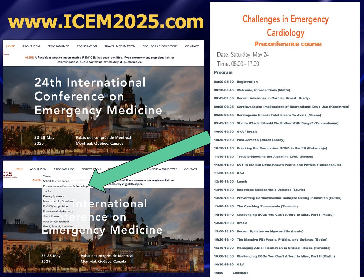 If you are heading to Montreal for ICEM, make sure to check out the Challenges in Emergency Cardiology Preconference course...time is running out!