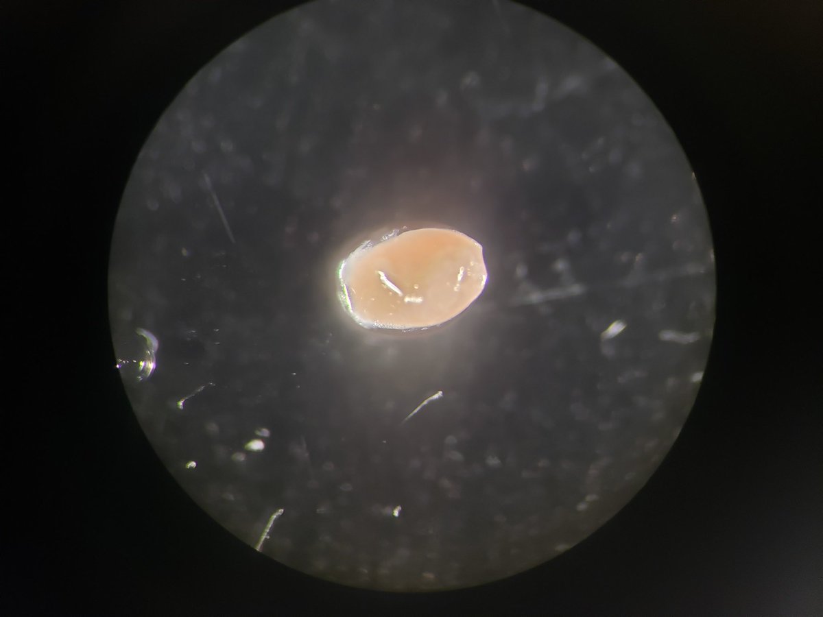 arturini32's tweet photo. I’m thrilled to share that our paper on the sex-dependent effects of FGF21 in adrenal regeneration after CS has just been published in Molecular Metabolism🎉. Those nights in Barcelona studying mouse circadian rhythms will always be great memories! #FGF21 #Adrenalinsufficiency https://t.co/eFOtSYV9qO
