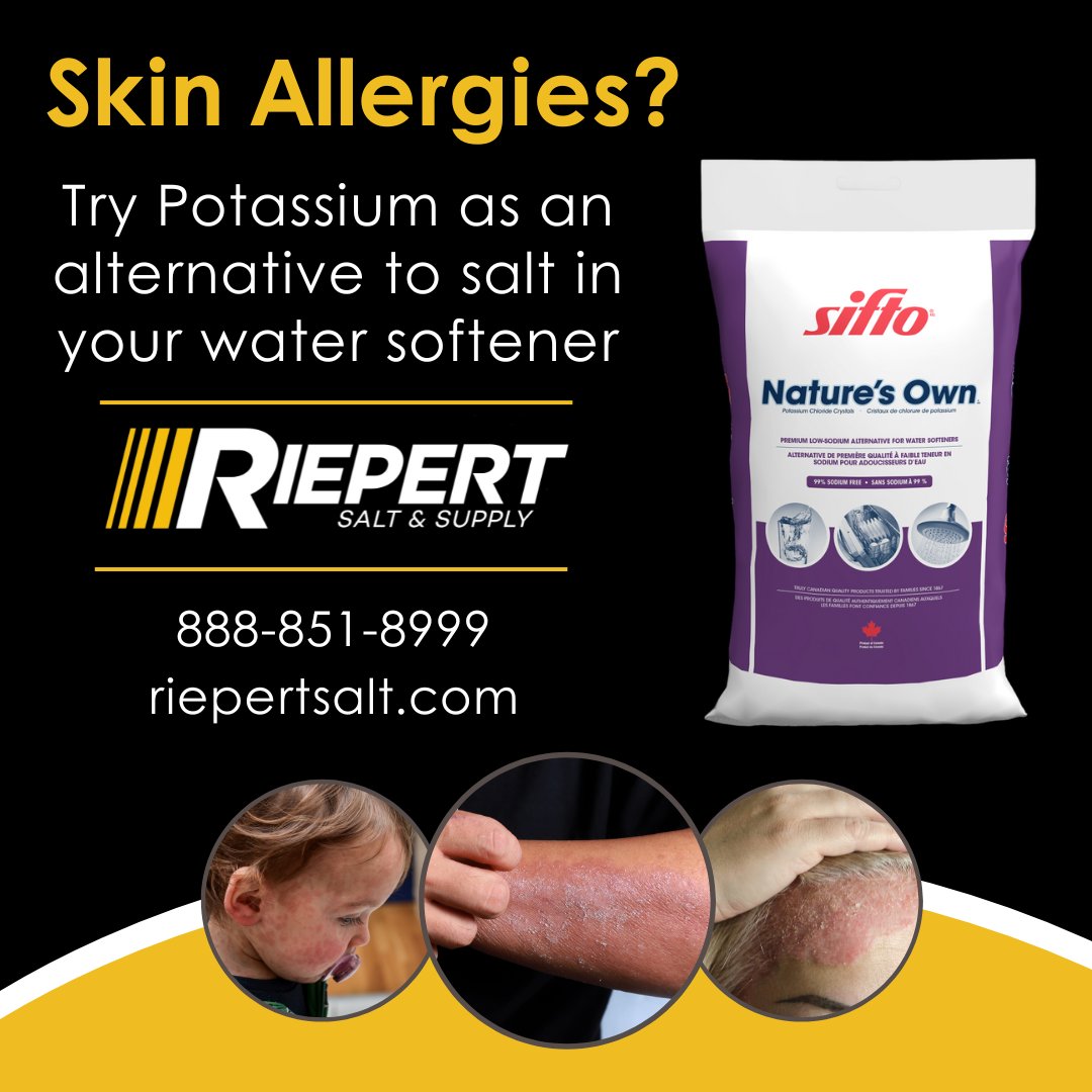 #eczema #psoriasis #SensitiveSkin #PotassiumChloride #watersoftener
