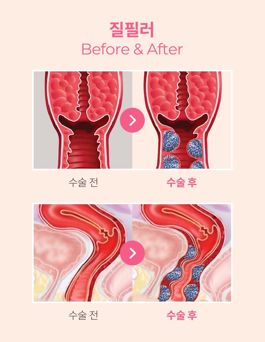 그러니까 🤏 이만한 남자를 위해서 이런 짓까지 했다는 거잖아