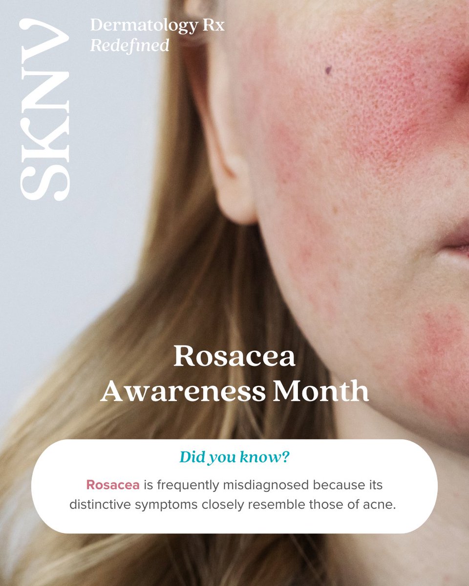 April is #Rosacea Awareness Month!

Rosacea affects millions—but many people don’t even know they have it. Redness, flushing, visible blood vessels, and bumps are just some of the signs that often get overlooked or mistaken for something else.

Raising awareness starts with