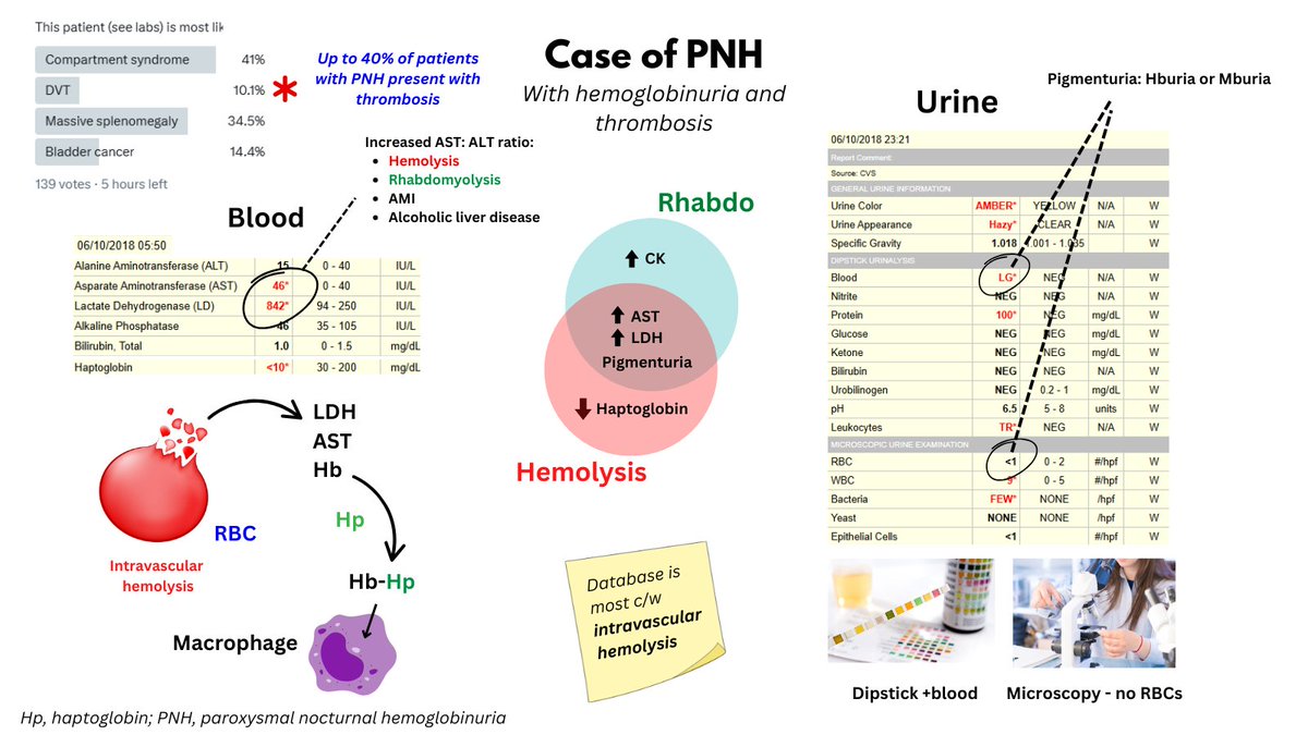 PAROXYSMAL NOCTURNAL HEMOGLOBINURIA

I posted a poll yesterday asking what the most likely presentation was of a patient with labs c/w hemolysis and hemoglobinuria. 

DVT was the least popular answer but the correct one!