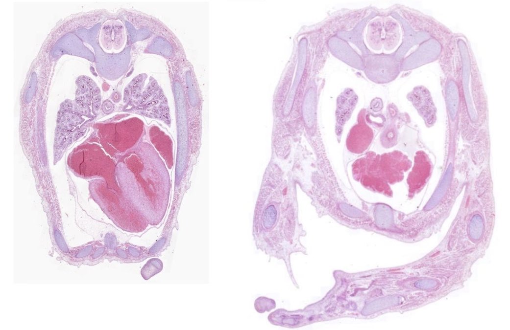 microscopio_v's tweet image. Siguiendo con desarrollo, tenemos 2 nuevos preparados: cortes transversales a nivel torácico, etapa fetal
microscopiovirtual.fmed.edu.uy/c_d_embrion_fe…