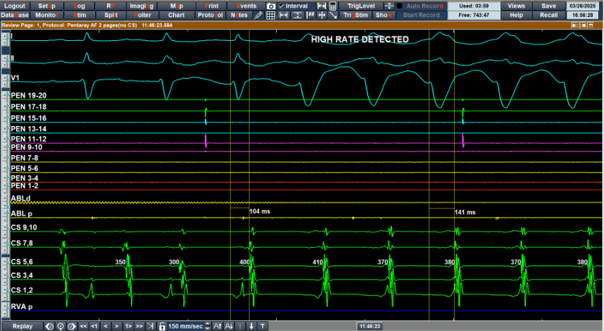 syamkumarmd's tweet photo. The same case was posted earlier, with EPS results. Where is the location? #EPeeps #Fellowsfirst https://t.co/w92G1LFTYb