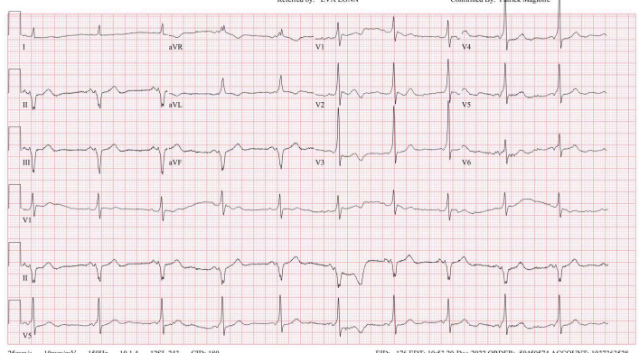 syamkumarmd's tweet photo. The same case was posted earlier, with EPS results. Where is the location? #EPeeps #Fellowsfirst https://t.co/w92G1LFTYb