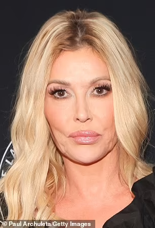 GeneralJoeM17's tweet photo. Does this look like bad plastic surgery or someone who lost access to the "special sauce"
Thats Brandi Glanville. https://t.co/LYKXr2zRfZ