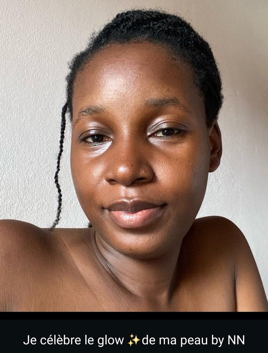 NouNyanga's tweet image. 🌸 CÉLÉBRONS AVEC ELLE.😍

Même si tu es fan de make-up, imagine-toi avec sa peau. Quand tu poses le make-up dessus, le rendu est #impeccable !👌🏽 Un coup de cœur de cette Perle, notre #microneedling.

#NouNyanga #ClienteSatisfaite #PeauSaine #BeautéNaturelle #SoinPeau #SkinCare