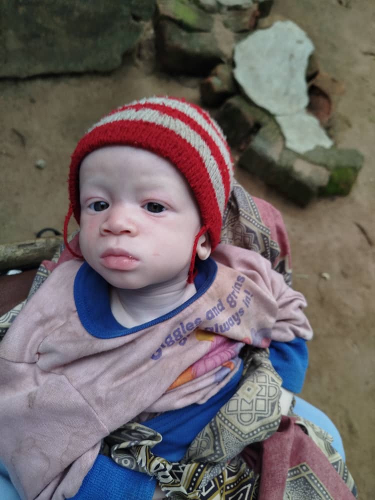 La inmensa alegría de ver salir al contenedor cargado con fotoprotectores donados por <a href="/ISDIN/">ISDIN</a> para las personas con albinismo de Mozambique. Así se reducirá el riesgo de contraer cáncer de piel y muertes muy dolorosas
 MuchasGracias <a href="/ISDIN/">ISDIN</a> y a todos los que lo habéis hecho posible