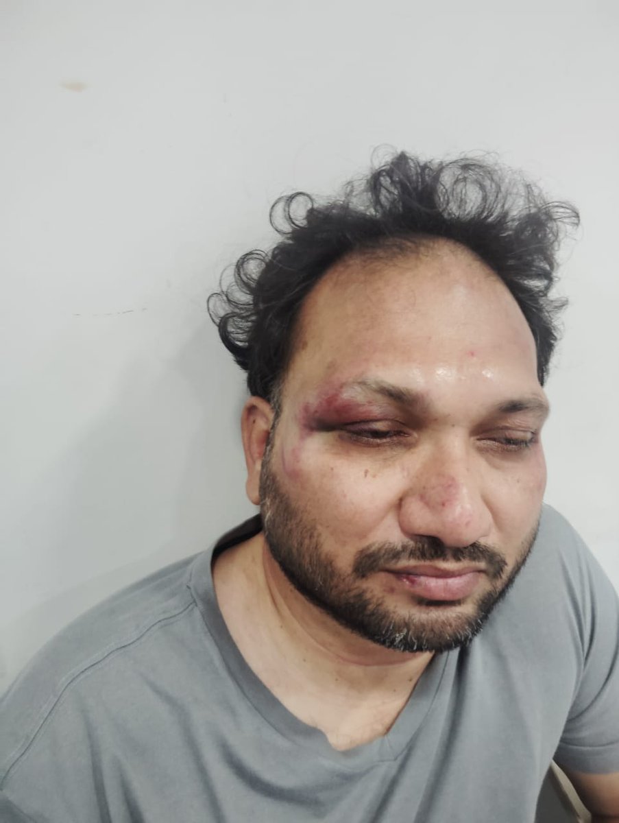 daramonigirish's tweet photo. All they could do is just hit me or to their best they can kill me...may note u cannot stop me...
Attack at office thrice, 3 FIR's
Yet again @bandisanjay_bjp uses and flexes his muscles and orders a brutal attack on me n family...hoping for police action @cyberabadpolice
@narendramodi @RSSorg @AmitShah @JPNadda @HMOIndia