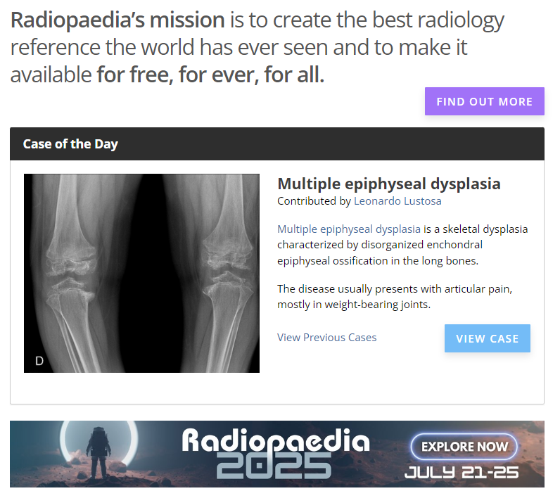 Leonardo Lustosa 🦴 (@drleolustosa) on Twitter photo Always nice to have a case featured on <a href="/Radiopaedia/">Radiopaedia.org</a>'s homepage. Have you ever seen a case of Multiple Epiphyseal Dysplasia?
🔗Learn more about this rare condition: radiopaedia.org/cases/194154 Always nice to have a case featured on <a href="/Radiopaedia/">Radiopaedia.org</a>'s homepage. Have you ever seen a case of Multiple Epiphyseal Dysplasia?
🔗Learn more about this rare condition: radiopaedia.org/cases/194154