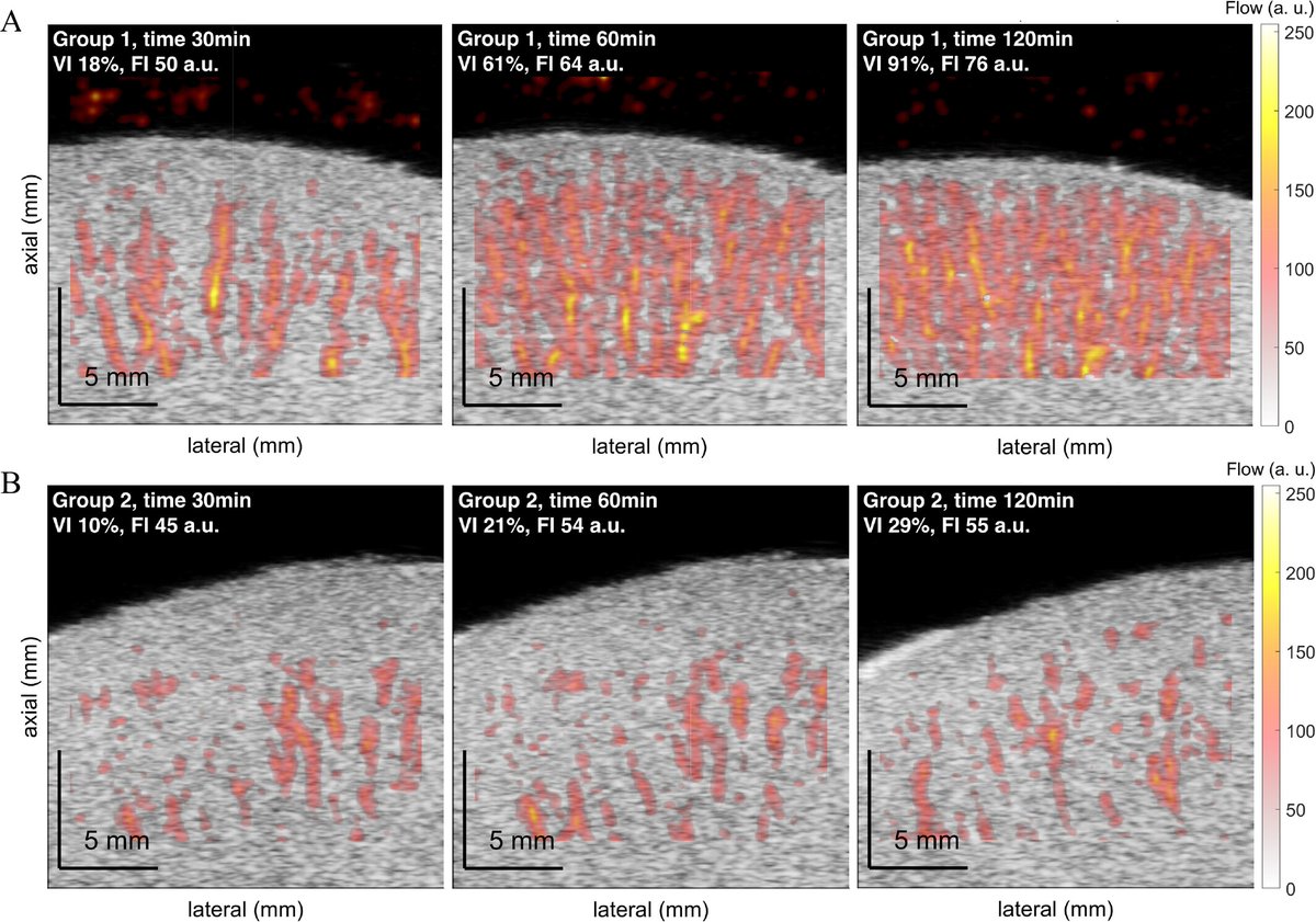 Artificial Organs (@artiforgans) on Twitter photo Enhancing #KidneyQuality Assessment: Power #Doppler During #NormothermicMachinePerfusion
👉tinyurl.com/ayzkkyar
<a href="/ErasmusMC/">Erasmus MC</a>🇳🇱| <a href="/GijsvanSoest/">Gijs van Soest 🧢</a> #ExperimentalAnimalModel Enhancing #KidneyQuality Assessment: Power #Doppler During #NormothermicMachinePerfusion
👉tinyurl.com/ayzkkyar
<a href="/ErasmusMC/">Erasmus MC</a>🇳🇱| <a href="/GijsvanSoest/">Gijs van Soest 🧢</a> #ExperimentalAnimalModel