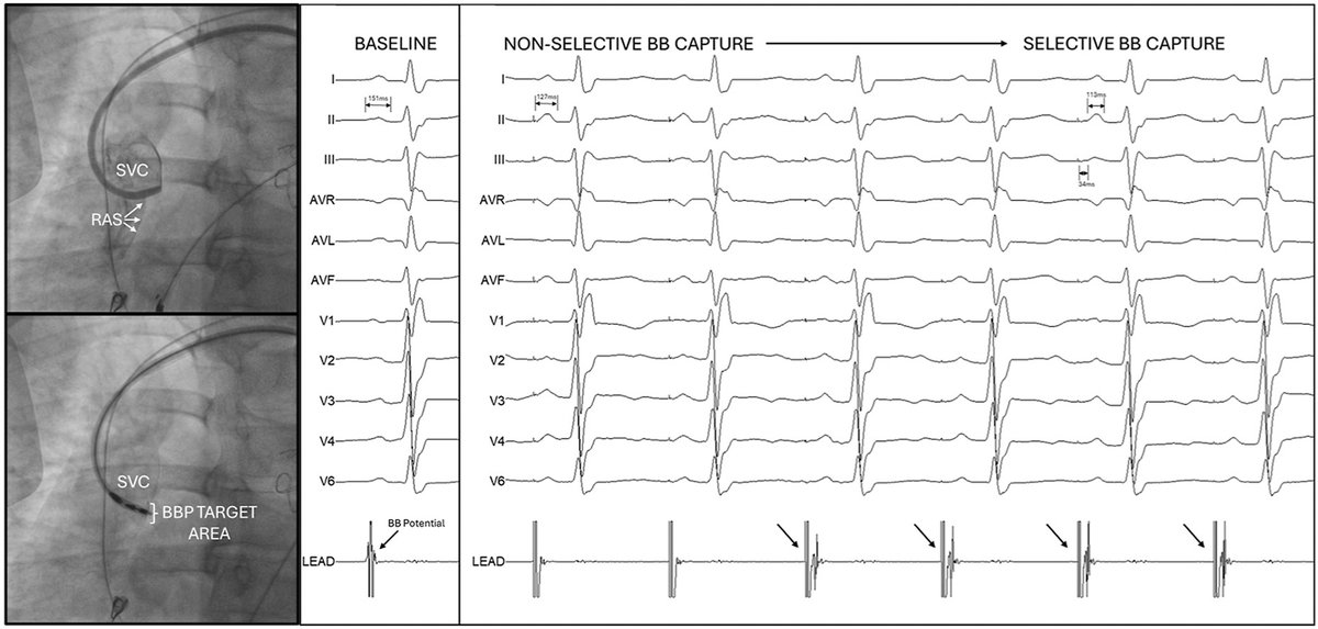 Sandeep Gautam tweet media