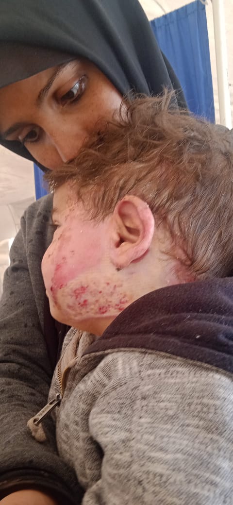 Heba in Gaza🕊️🍉💔 tweet media