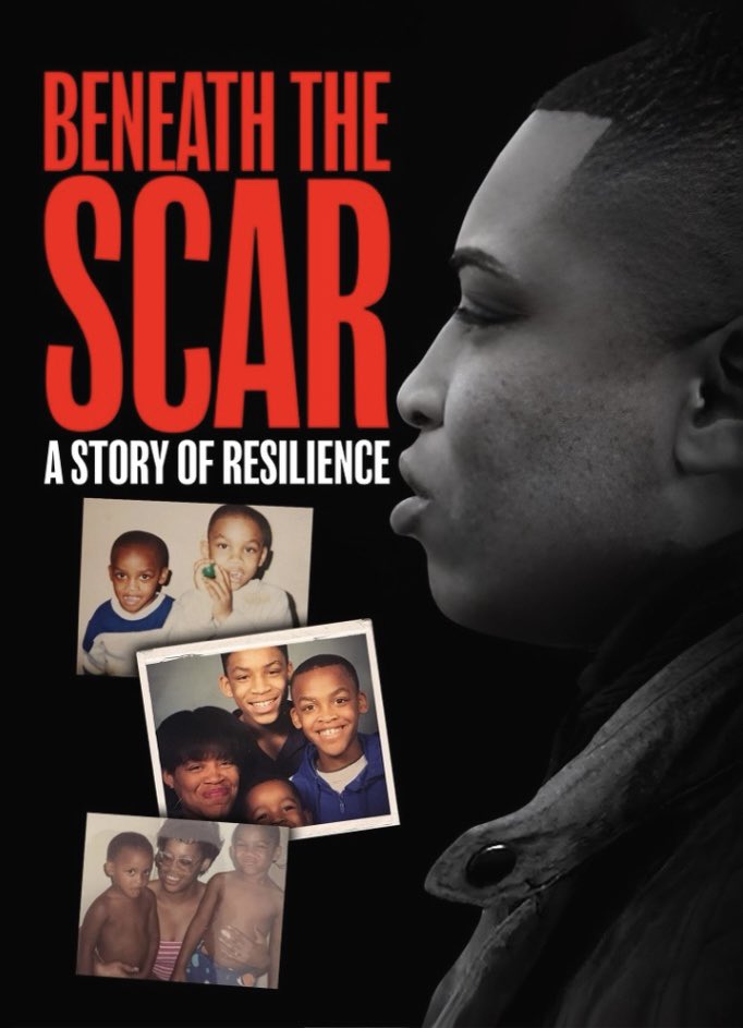 The moment is finally here—Beneath The Scar: A Story of Resilience is now available for early release on Prime Video!
