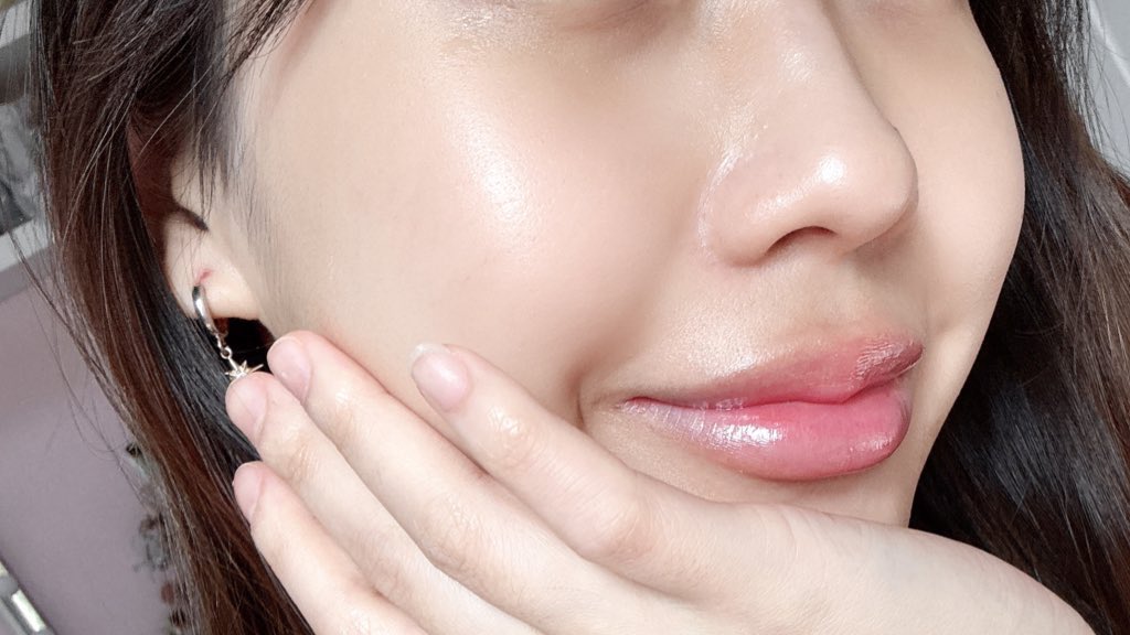 น้ำตบหน้าใสตัวนี้เตรียมแมสได้เลย ยูเซอรินเขาออกน้ำตบมาใหม่ ที่ใส่ไทอามิดอล สารไบรท์เทนนิ่งที่โคตรเก่งสะเทือนวงการน้ำตบ ใครรู้จักจะรู้ว่ามันจึ้งงงงง ผิวสว่างขึ้นจริง รอยดำจาง แล้วปรับสูตรใหม่ช่วยให้ผิวแข็งแรง ชุ่มชื้นขึ้นมากด้วย เนื้อใสๆ ซึมไว ผิวเป็นแก้วเป็นแสงเว่อ 1000/10 พ้มรัก😭🫴🏻