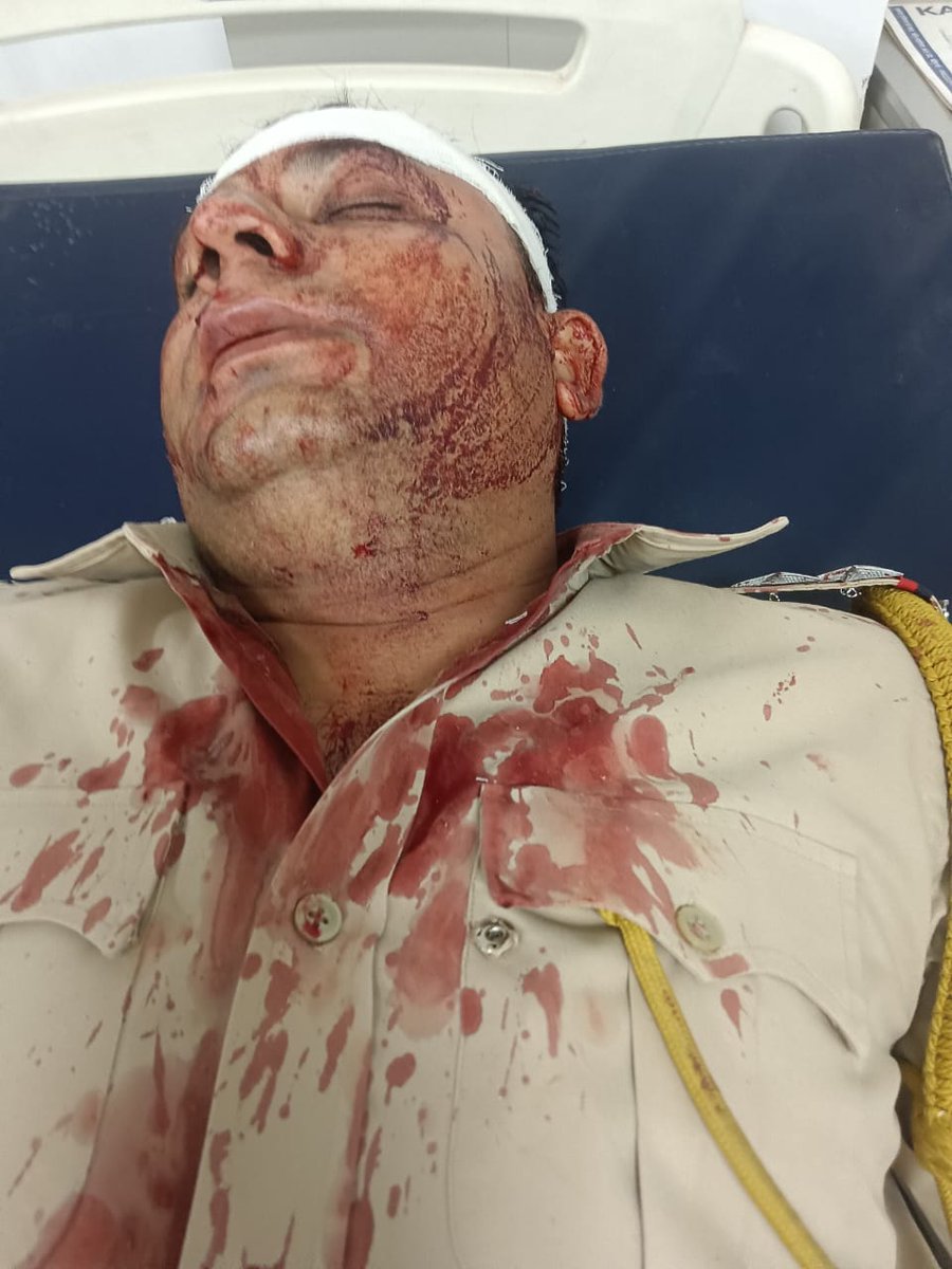 आज डब्बा वाली ढाणी अजीतगढ़ में पुलिस को बंधक बनाकर किया गया हमला !
11 पुलिसकर्मी हुए  घायल  
 कौन है इन पुलिस वालों के लिए न्याय के लिए आगे आएगा 
#पुलिस_हमला