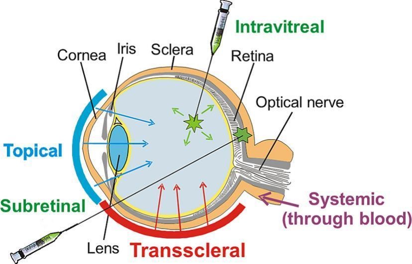 Editors of Advanced Drug Delivery Reviews (@addreditors) on Twitter photo ADDR 50 days' free access: Optical coherence tomography for noninvasive monitoring of drug delivery.
By Kirill V. Larin & coworker <a href="/UHouston/">University of Houston</a>
#tomography #intravitreal #subretinal
kwnsfk27.r.eu-west-1.awstrack.me/L0/https:%2F%2… ADDR 50 days' free access: Optical coherence tomography for noninvasive monitoring of drug delivery.
By Kirill V. Larin & coworker <a href="/UHouston/">University of Houston</a>
#tomography #intravitreal #subretinal
kwnsfk27.r.eu-west-1.awstrack.me/L0/https:%2F%2…
