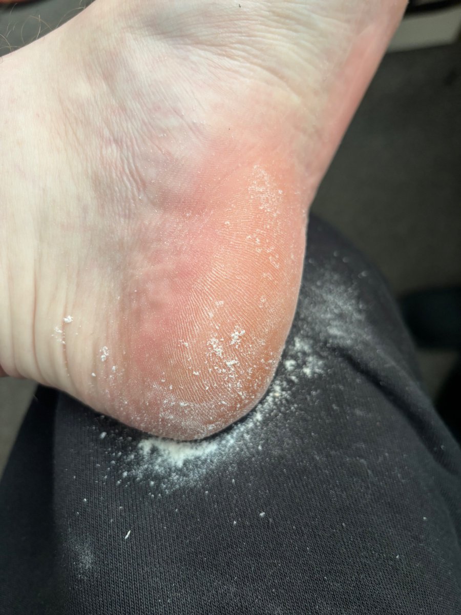 RealMasterJames's tweet photo. Who'd like to eat this delicious foot dust 😂  #feet https://t.co/W3Gd22BSXV