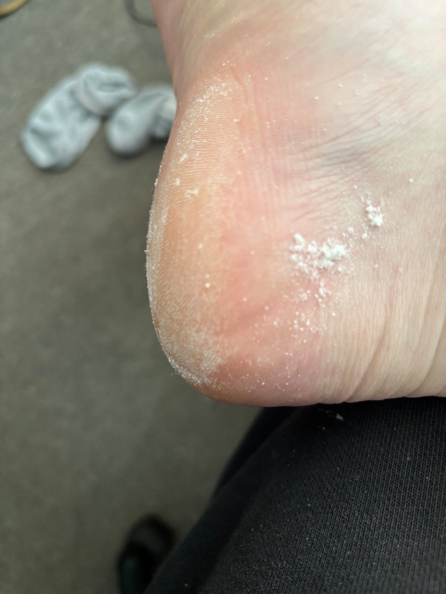 RealMasterJames's tweet photo. Who'd like to eat this delicious foot dust 😂  #feet https://t.co/W3Gd22BSXV