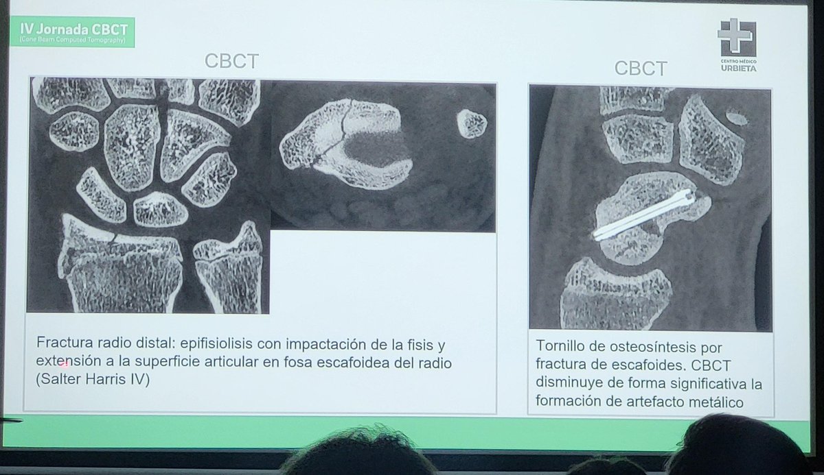 jornada CBCT y aplicaciones en msk.