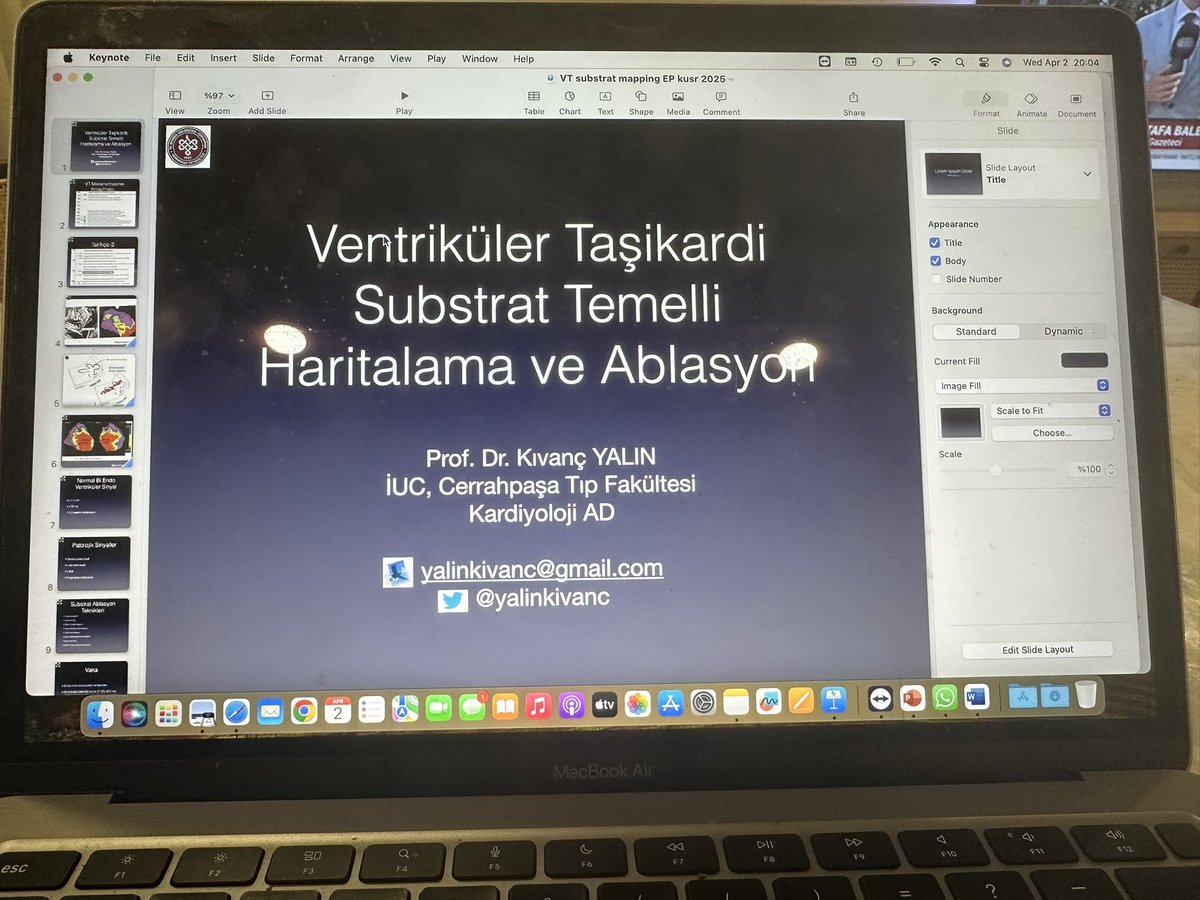 Kıvanç YALIN (@yalinkivanc) on Twitter photo Cumartesi TKD Elektrofizyoloji Eğitim Programında Substrat Temelli VT haritalaması ve Ablasyonu konuşacağız. hazır mıyız? <a href="/TKDsosyal/">Turkish Society of Cardiology</a> <a href="/taylanakgun/">Taylan Akgün</a> <a href="/hakan__yalman/">Hakan</a> <a href="/aliugursoysal/">Ali Uğur Soysal</a> <a href="/CerrahpasaC/">Cerrahpasa cardiology</a> Cumartesi TKD Elektrofizyoloji Eğitim Programında Substrat Temelli VT haritalaması ve Ablasyonu konuşacağız. hazır mıyız? <a href="/TKDsosyal/">Turkish Society of Cardiology</a> <a href="/taylanakgun/">Taylan Akgün</a> <a href="/hakan__yalman/">Hakan</a> <a href="/aliugursoysal/">Ali Uğur Soysal</a> <a href="/CerrahpasaC/">Cerrahpasa cardiology</a>