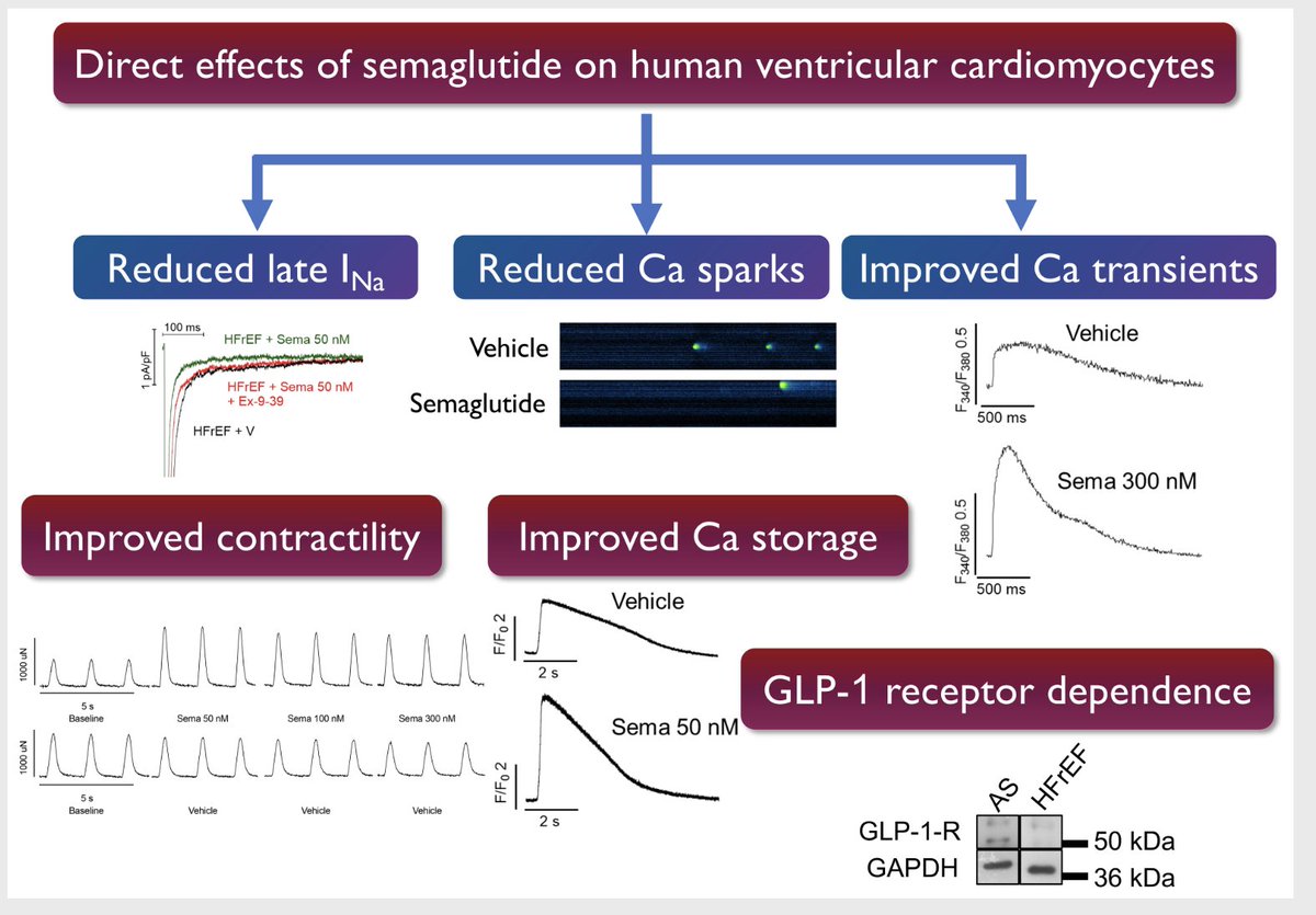 🚨 New insights on #Semaglutide in HF! 🚨
👉 modulates ion homeostasis in human cardiomyocytes, ⬇️ proarrhythmic SR Ca²⁺ leak &amp; enhancing systolic function. This may explain its cardioprotective benefits &amp; therapeutic potential in HF
onlinelibrary.wiley.com/doi/epdf/10.10…

<a href="/AmrAbdin10/">Amr Abdin</a>