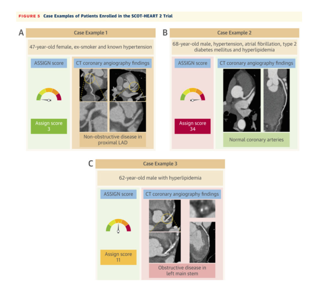 DrJMarine's tweet image. Thank you ⁦@DineshKalra⁩ for a superb ⁦@hopkinsheart⁩ Grand Rounds this AM on coronary CTA to guide ASCVD prevention. Great work you are doing at ⁦@UofLCardiology⁩ ! ⁦@rblument1⁩ ⁦@HeartOTXHeartMD⁩ ⁦@drdavemd ⁦@hvanspall⁩ ⁦