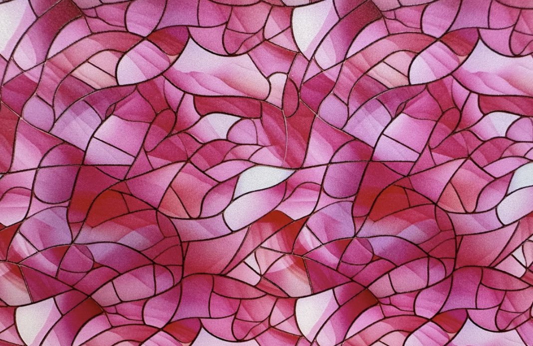 Stained glass or adenomatous hyperplasia of the thyroid? There's so much beauty in pathology! 

<a href="/ElaineHuMD/">Elaine H</a> <a href="/Maicroanatomy/">Mai S</a> <a href="/JuanPathMD/">Conan</a> <a href="/LordoftheSlides/">Clayton Smith, MD</a> <a href="/GIJamesMD/">GI James</a>