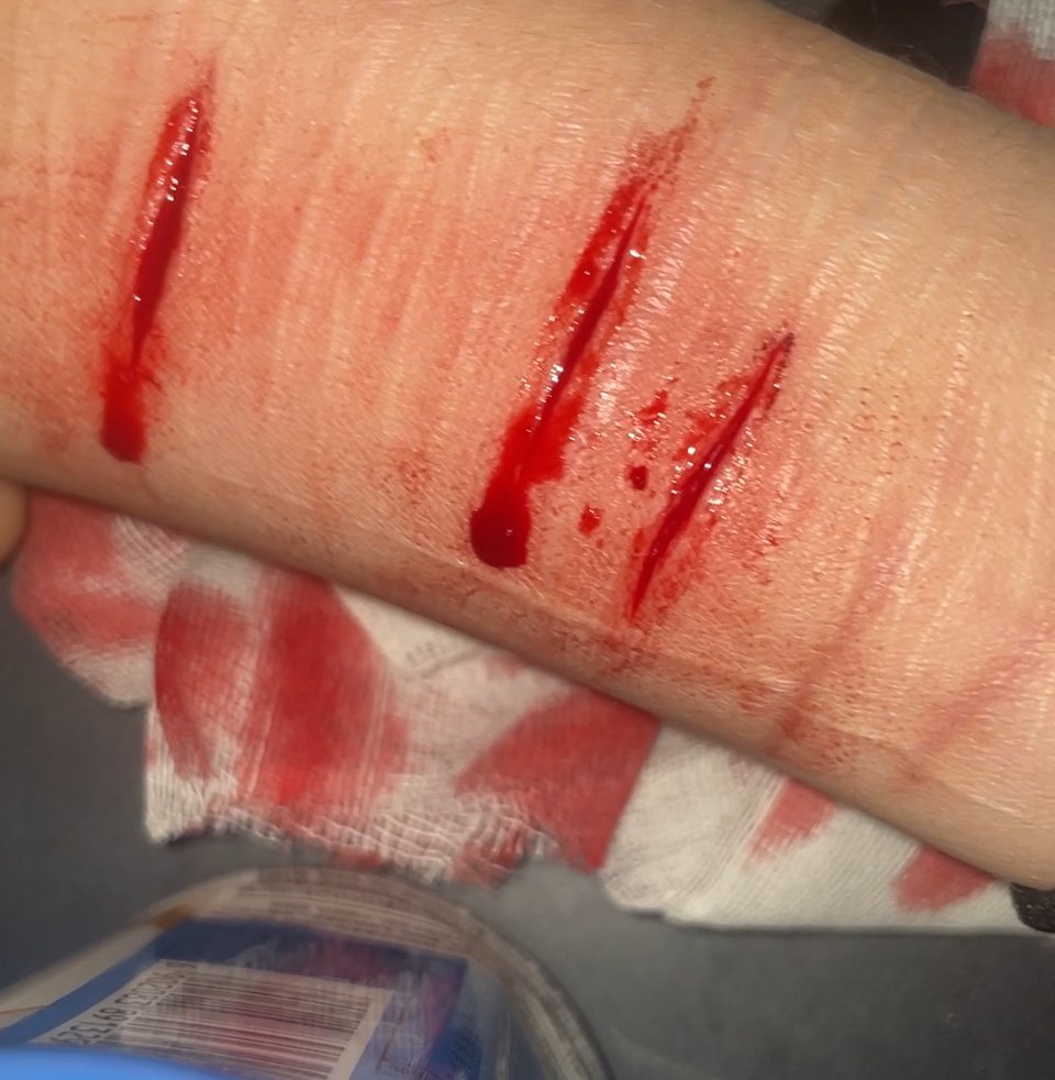 想磕右美，但现在没有渠道了，就剩之前囤的几盒了😢