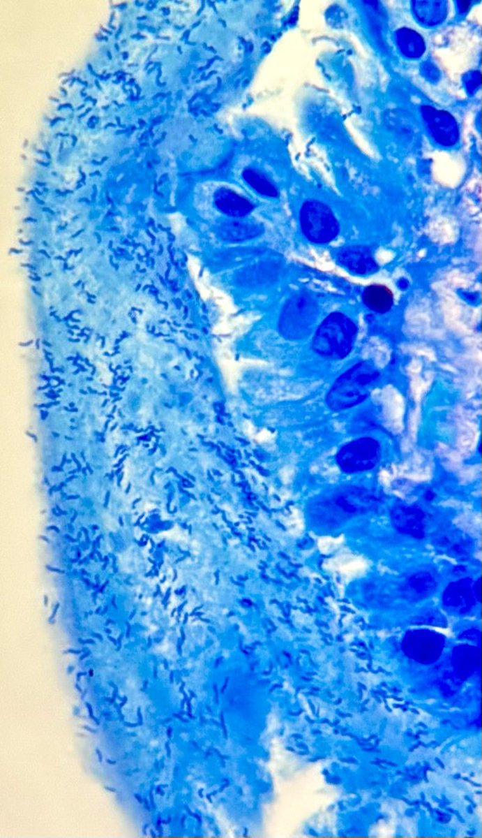 Just a few Helicobacter pylori 😅 #Pathology #MedX #PathX #pathart