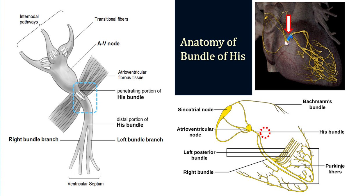 Anatomy of the Bundle of His
The bundle of His is a singular, unidirectional structure located at the atrial outlet, acting as a vital conduit between the atrioventricular node (AVN) and the left and right bundle branches. Its distinct anatomical features highlight its essential